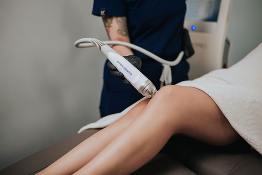 Radiofrequency with microneedles (INTENSIF)